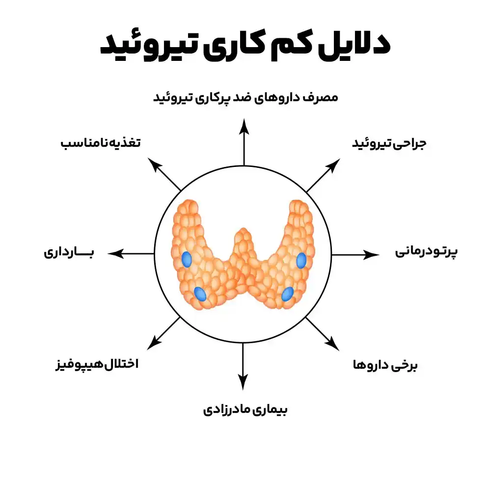 کم‌ کاری تیروئید